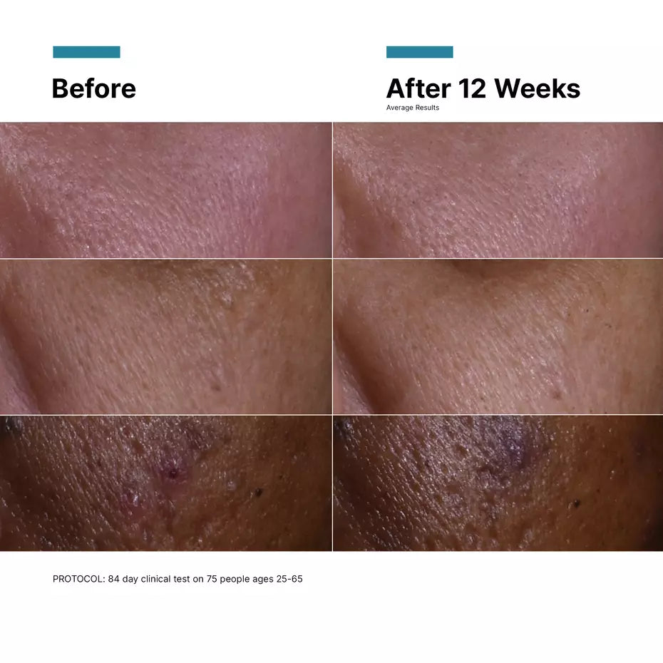 SkinCeuticals CE Ferulic Vitamin C Serum