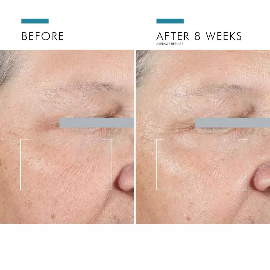 SkinCeuticals A.G.E. Advanced Eye for Dark Circles