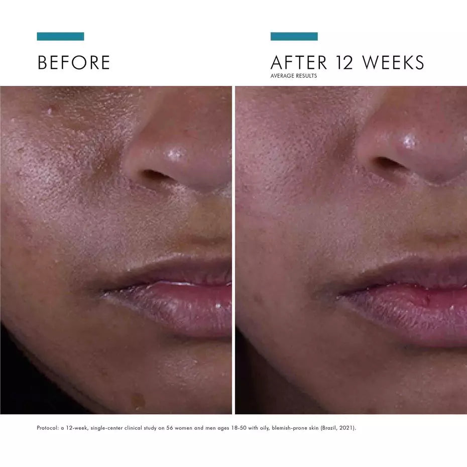 SkinCeuticals Silymarin CF Serum