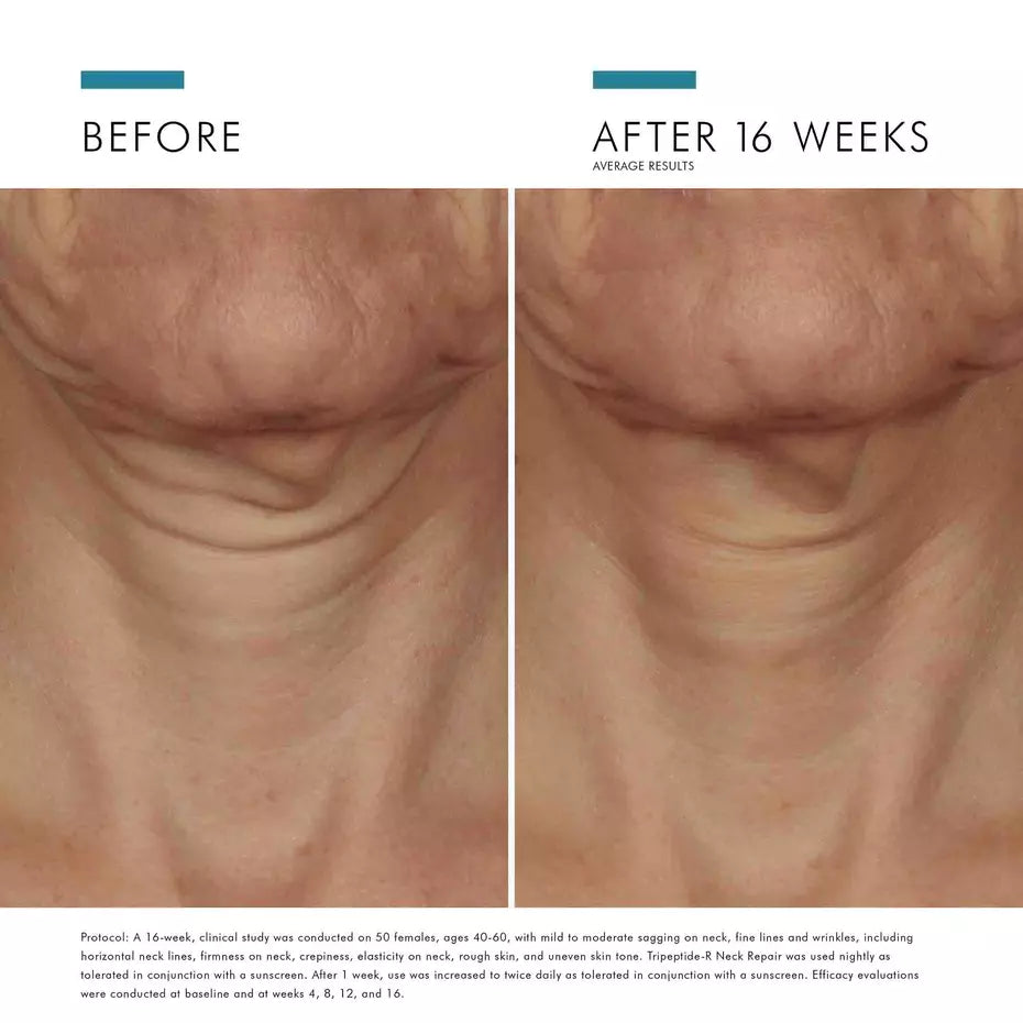 SkinCeuticals Tripeptide‑R Neck Repair Cream