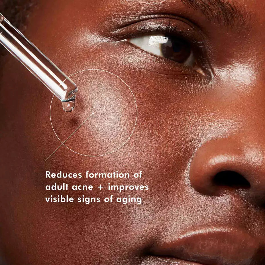 SkinCeuticals Blemish + Age Defense Serum